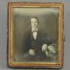 daguerreotype skin disease (1)