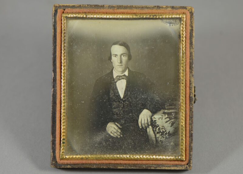 daguerreotype skin disease (1) daguerreotype skin disease (1)